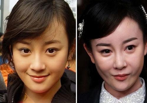 反对明星整容,守护自然之美